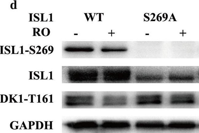 Fig.3.D showing Western Blotting from the publication: Phosphorylation of islet-1 serine 269 by CDK1 increases its transcriptional activity and promotes cell proliferation in gastric cancer.