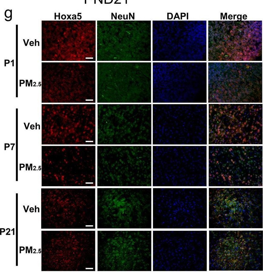 Fig.5.G showing Immunocytochemistry-immunofluorescence from the publication: Prenatal PM2.5 exposure impairs spatial learning and memory in male mice offspring: from transcriptional regulation to neuronal morphogenesis.