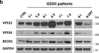 Fig.3.B showing Western Blotting from the publication: Autophagy dysregulation in Danon disease.