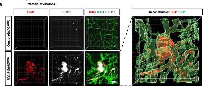 Fig.4.E showing Immunohistochemistry-immunofluorescence from the publication: MEK inhibition reduced vascular tumor growth and coagulopathy in a mouse model with hyperactive GNAQ.