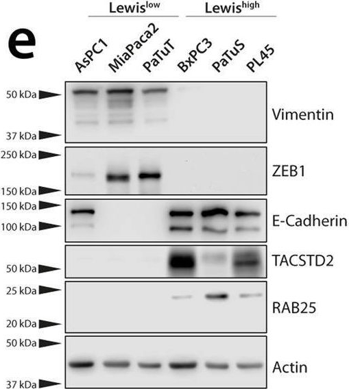 Fig.4.E showing Western Blotting in a Homo sapiens (Human) sample from the publication: Analysis of the glyco-code in pancreatic ductal adenocarcinoma identifies glycan-mediated immune regulatory circuits.