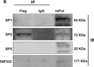 Fig.7.B showing Western Blotting from the publication: NFS1 Regulates IDH2 to Attenuate Abdominal Aortic Aneurysms via Interacting With SP2.