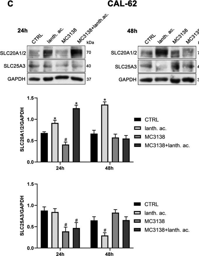 Fig.7.C showing Western Blotting in a Homo sapiens (Human) sample from the publication: SIRT5 Activation and Inorganic Phosphate Binding Reduce Cancer Cell Vitality by Modulating Autophagy/Mitophagy and ROS.