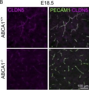 Fig.6.B showing Immunohistochemistry-immunofluorescence from the publication: Altered brain vascularization and transcriptional changes in embryos lacking ABCA1 support a role of cholesterol in brain angiogenesis.