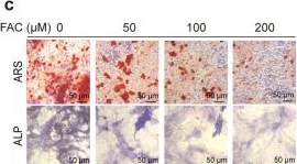 Fig.1.C showing Immunohistochemistry from the publication: FTMT-mediated suppression of mitophagy links iron accumulation to osteoporosis.
