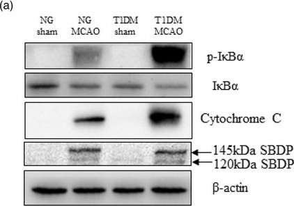 Fig.2.A showing Western Blotting in a Rattus norvegicus (Rat) sample from the publication: Melatonin mitigates type 1 diabetes-aggravated cerebral ischemia-reperfusion injury through anti-inflammatory and anti-apoptotic effects.