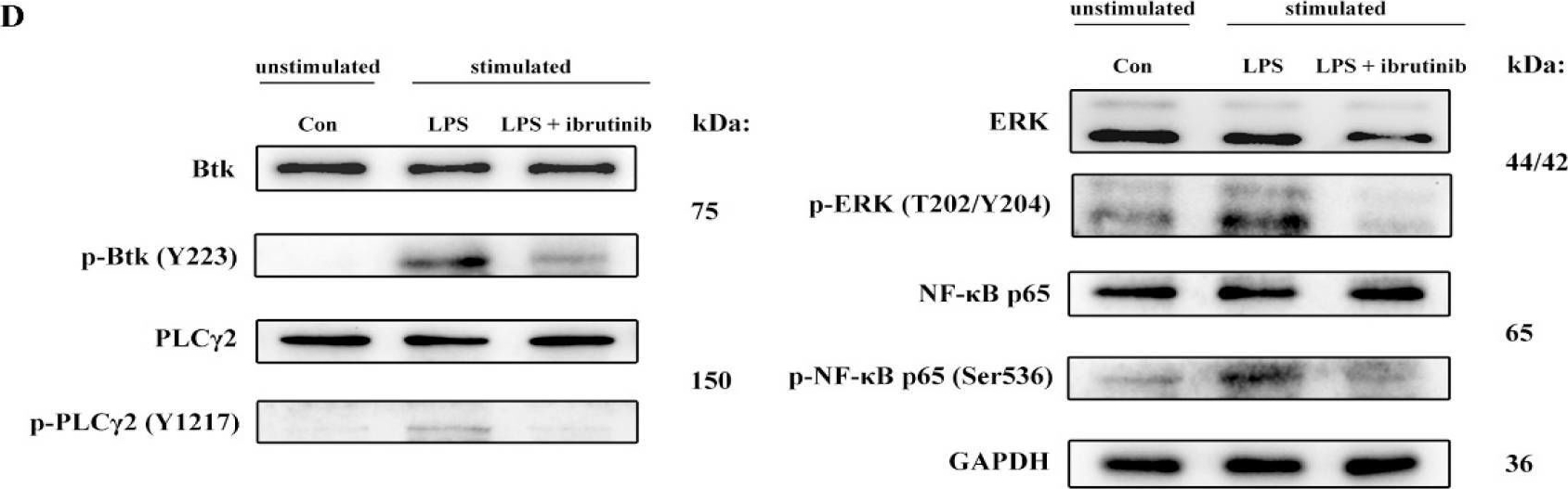 Fig.2.D showing Western Blotting in a Mus musculus (House mouse) sample from the publication: Ibrutinib Inhibits BTK Signaling in Tumor-Infiltrated B Cells and Amplifies Antitumor Immunity by PD-1 Checkpoint Blockade for Metastatic Prostate Cancer.