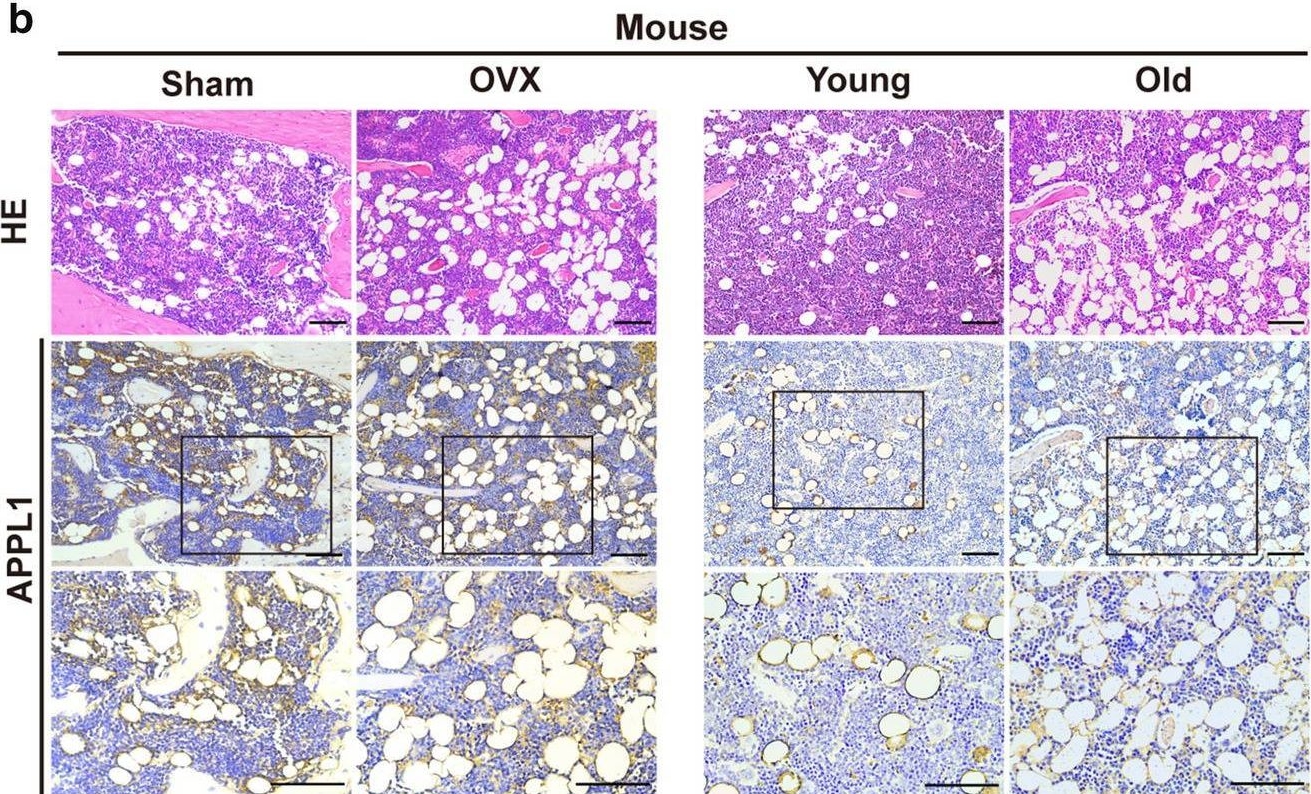 Fig.1.B showing Immunohistochemistry in a Mus musculus (House mouse) sample from the publication: Impairment of APPL1/Myoferlin facilitates adipogenic differentiation of mesenchymal stem cells by blocking autophagy flux in osteoporosis.