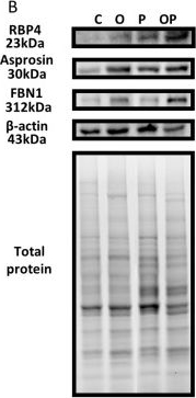 Fig.6.B showing Western Blotting in a Rattus norvegicus (Rat) sample from the publication: Increased RBP4 and Asprosin Are Novel Contributors in Inflammation Process of Periodontitis in Obese Rats.