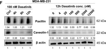 Fig.3.F showing Western Blotting from the publication: Dasatinib Inhibits Basal B Breast Cancer Through ETS1-Mediated Extracellular Matrix Remodeling.