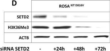 Fig.1.D showing Western Blotting from the publication: SETD2 non genomic loss of function in advanced systemic mastocytosis is mediated by an Aurora kinase A/MDM2 axis and can be therapeutically targeted.