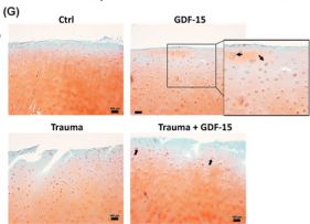 Fig.6.G showing Immunohistochemistry from the publication: Growth/Differentiation Factor 15 Promotes a Pro-Regenerative Response in Chondrocytes Upon Cartilage Injury.