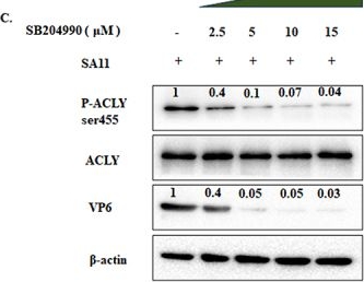 Fig.3.C showing Western Blotting from the publication: Rotavirus-NSP5 interacts with and hijacks host ATP citrate lyase to viroplasms, enhancing lipid biosynthesis for facilitating rotavirus infection.