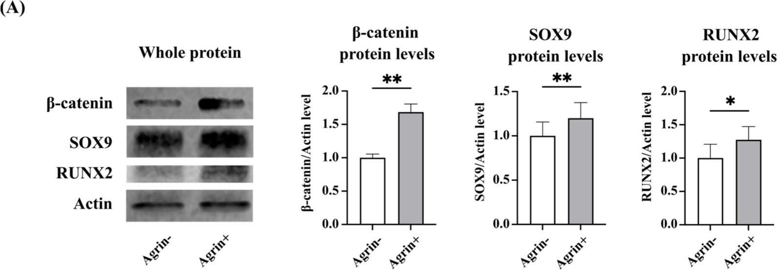 Fig.6.A showing Western Blotting in a Homo sapiens (Human) sample from the publication: LRP4 and Agrin Are Modulated by Cartilage Degeneration and Involved in β-Catenin Signaling in Human Articular Chondrocytes.
