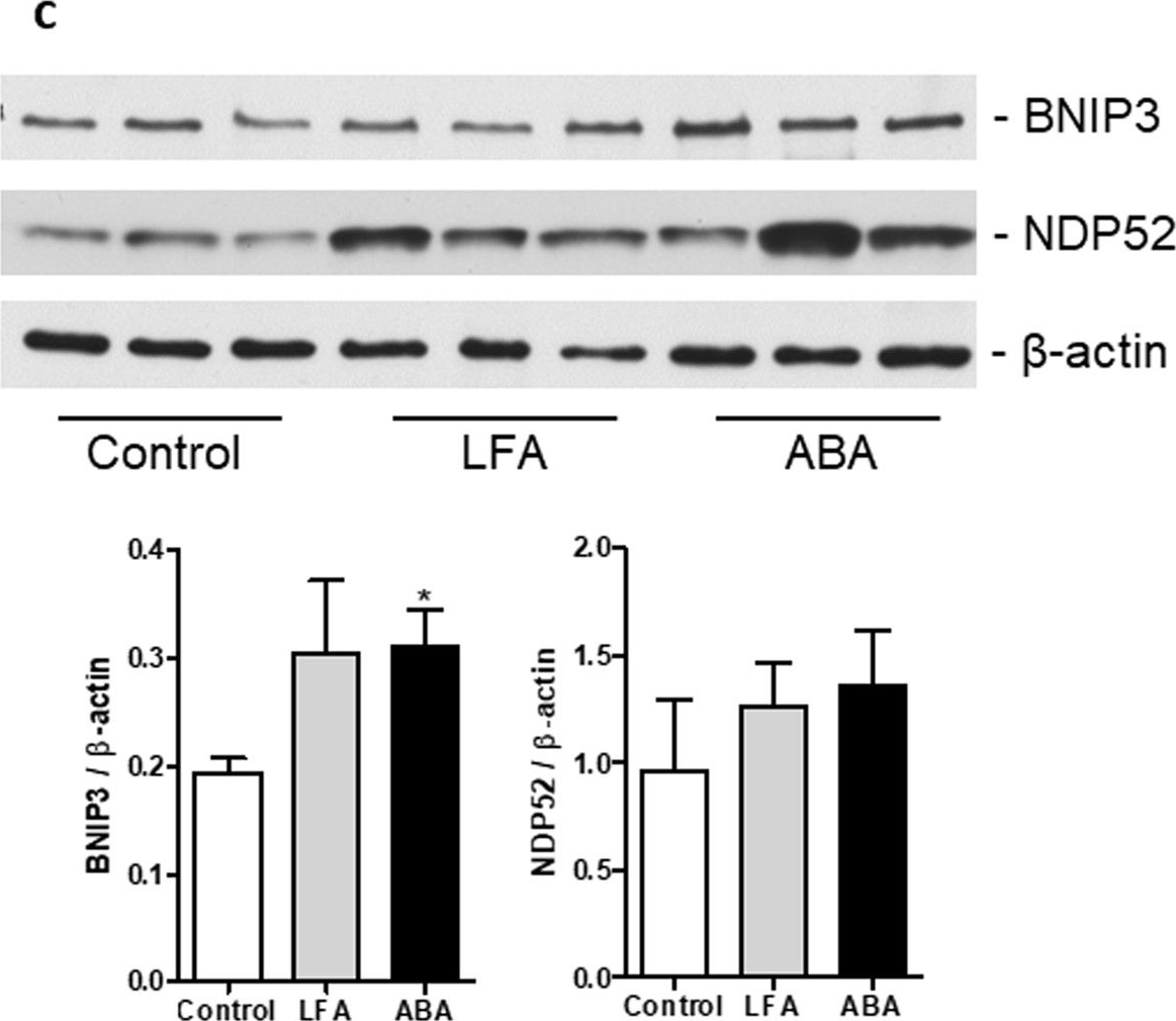 Fig.7.C showing Western Blotting in a Mus musculus (House mouse) sample from the publication: Alterations of proteome, mitochondrial dynamic and autophagy in the hypothalamus during activity-based anorexia.