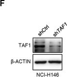 Fig.5.F showing Western Blotting from the publication: TAF1 Suppresses MHC-I Expression and Correlates with Poor Immunotherapy Response in Small Cell Lung Cancer.