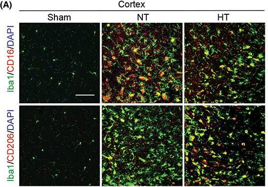 Fig.4.A showing Immunohistochemistry-immunofluorescence in a Mus musculus (House mouse) sample from the publication: Selective brain hypothermia attenuates focal cerebral ischemic injury and improves long-term neurological outcome in aged female mice.