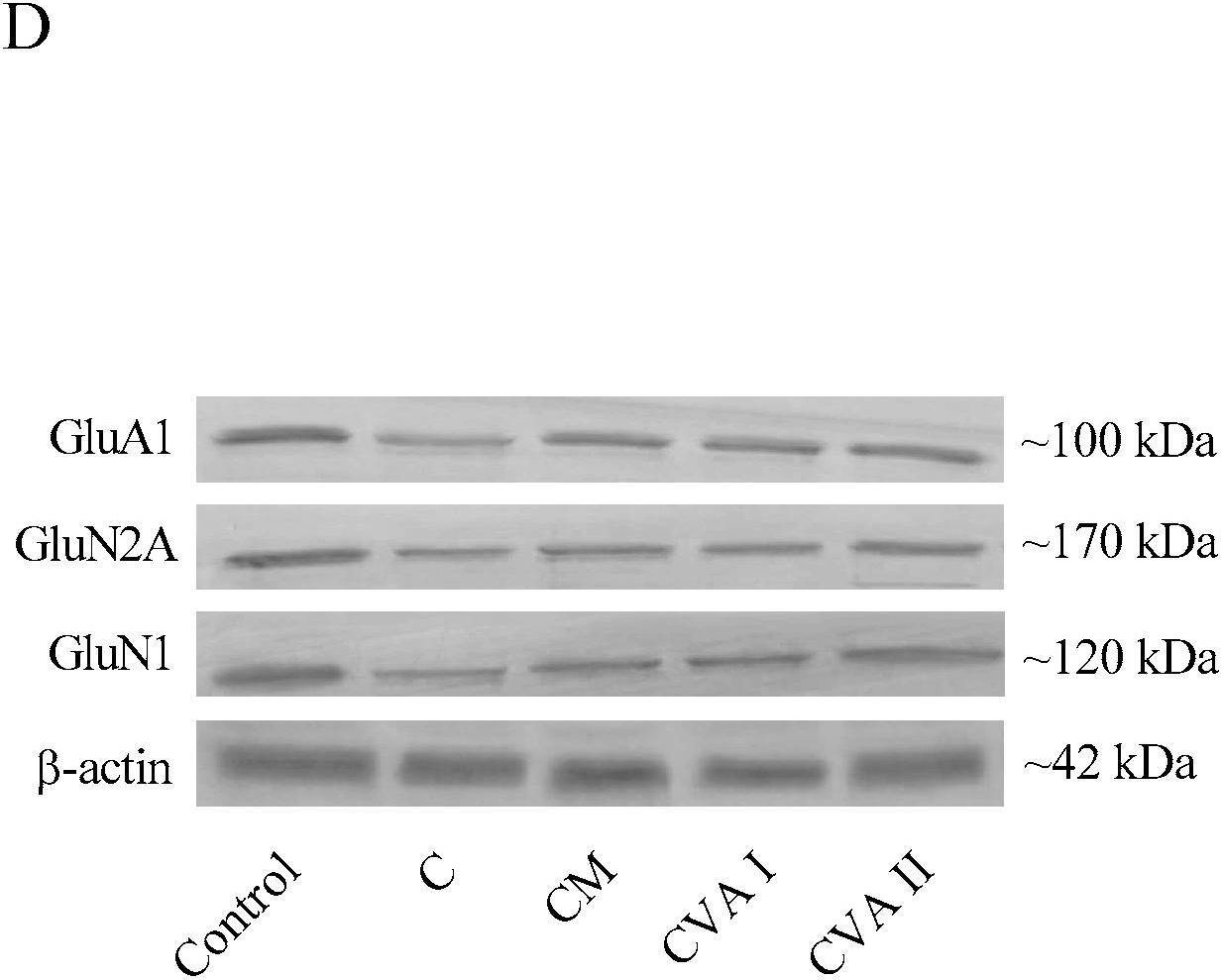 Fig.5.D showing Western Blotting from the publication: Impact of a Novel Valerian Extract on Sleep Quality, Relaxation, and GABA/Serotonin Receptor Activity in a Murine Model.