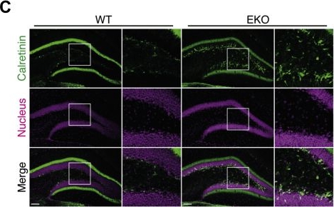 Fig.3.C showing Immunohistochemistry-immunofluorescence in a Mus musculus (House mouse) sample from the publication: Forebrain-specific deficiency of the GTPase CRAG/Centaurin-γ3 leads to immature dentate gyri and hyperactivity in mice.