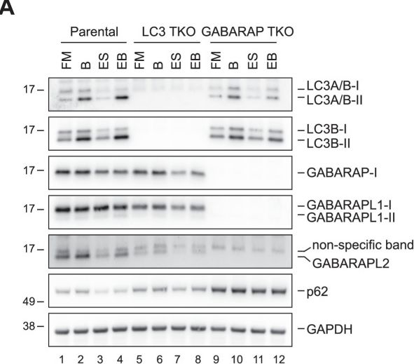 Fig.11.A showing Western Blotting in a Homo sapiens (Human) sample from the publication: GABARAP proteins regulate the packaging of HIV-1 genomic RNA into virions.