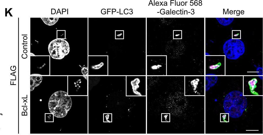 Fig.1.K showing Immunocytochemistry-immunofluorescence from the publication: Bcl-xL Affects Group A Streptococcus-Induced Autophagy Directly, by Inhibiting Fusion between Autophagosomes and Lysosomes, and Indirectly, by Inhibiting Bacterial Internalization via Interaction with Beclin 1-UVRAG.