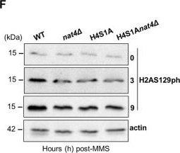 Fig.6.F showing Western Blotting in a Saccharomyces cerevisiae (Yeast) sample from the publication: Yeast Nat4 regulates DNA damage checkpoint signaling through its N-terminal acetyltransferase activity on histone H4.