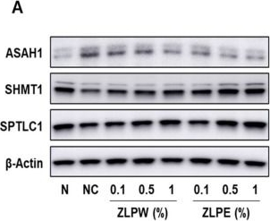 Fig.4.A showing Western Blotting in a Homo sapiens (Human) sample from the publication: Skin Barrier Enhancement and Moisturizing Effects of Exosome Extracts Derived from Pinus densiflora, Zanthoxylum piperitum, and Lagerstroemia indica Plants.