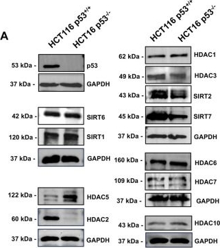 Fig.6.A showing Western Blotting in a Homo sapiens (Human) sample from the publication: p53 deficiency mediates cisplatin resistance by upregulating RRM2 and crotonylation of RRM2K283 through the downregulation of SIRT7.