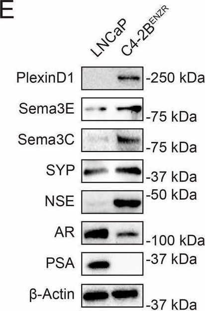 Fig.1.E showing Western Blotting in a Homo sapiens (Human) sample from the publication: PlexinD1 is a driver and a therapeutic target in advanced prostate cancer.