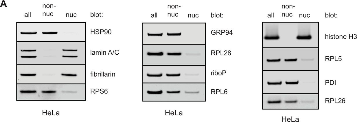Fig.6.A showing Western Blotting in a Homo sapiens (Human) sample from the publication: Paradoxical imbalance between activated lymphocyte protein synthesis capacity and rapid division rate.