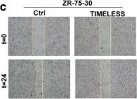 Fig.1.C showing Immunohistochemistry from the publication: TIMELESS inhibits breast cancer cell invasion and metastasis by down-regulating the expression of MMP9.