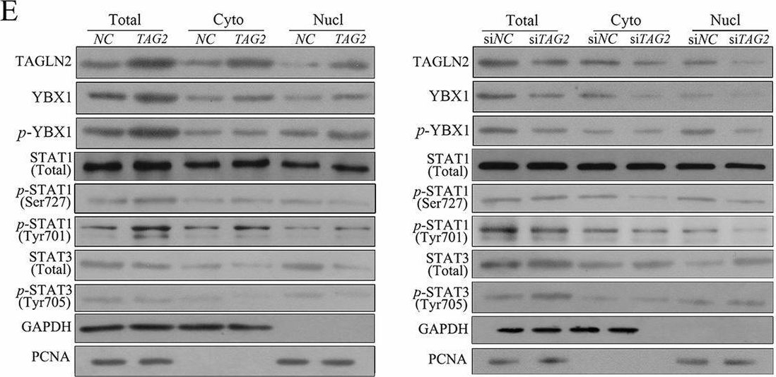 Fig.5.E showing Western Blotting in a Homo sapiens (Human) sample from the publication: TAGLN2 induces resistance signature ISGs by activating AKT-YBX1 signal with dual pathways and mediates the IFN-related DNA damage resistance in gastric cancer.