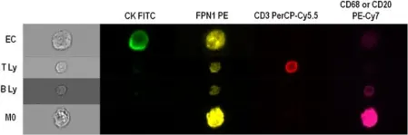 Fig.7.A showing Flow cytometry/Cell sorting in a Homo sapiens (Human) sample from the publication: Local iron homeostasis in the breast ductal carcinoma microenvironment.