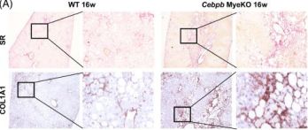 COL1A1 Antibody (E8I9Z) | Cell Signaling Technology