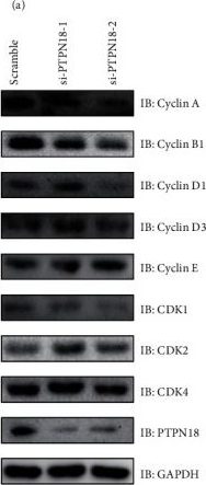 Fig.6.A showing Western Blotting from the publication: PTPN18 Serves as a Potential Oncogene for Glioblastoma by Enhancing Immune Suppression.