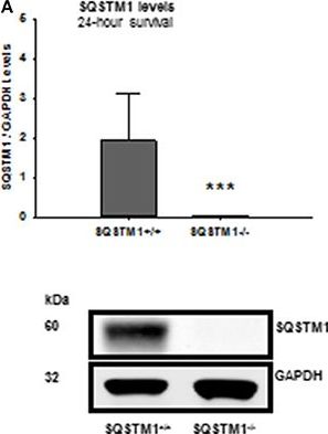 Sequestosome 1 Deficiency Delays, but Does Not Prevent Brain Damage Formation Following Acute Brain Injury in Adult Mice.
