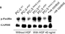 Fig.5.B showing Western Blotting in a Homo sapiens (Human) sample from the publication: Knockdown of WAVE3 impairs HGF induced migration and invasion of prostate cancer cells.