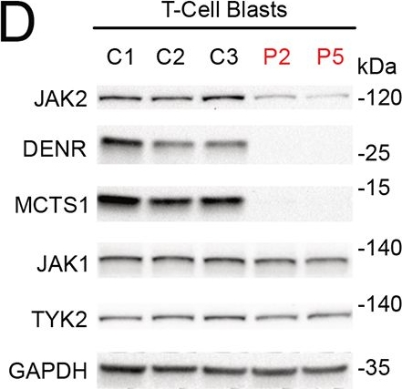 Fig.5.D showing Western Blotting in a Homo sapiens (Human) sample from the publication: Human MCTS1-dependent translation of JAK2 is essential for IFN-γ immunity to mycobacteria.