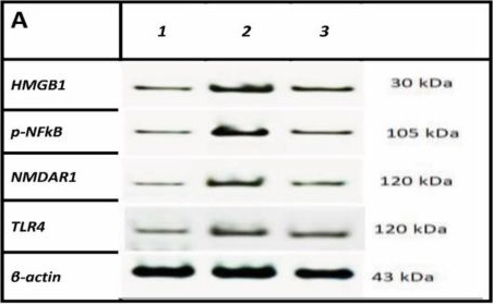 Fig.4.A showing Western Blotting from the publication: Novel Mechanism for Memantine in Attenuating Diabetic Neuropathic Pain in Mice via Downregulating the Spinal HMGB1/TRL4/NF-kB Inflammatory Axis.