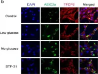 Fig.5.B showing Immunocytochemistry-immunofluorescence from the publication: Glucose Deficiency Elevates Acid-Sensing Ion Channel 2a Expression and Increases Seizure Susceptibility in Temporal Lobe Epilepsy.