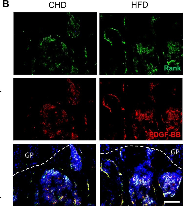Fig.1.B showing Immunofluorescence in a Mus musculus (House mouse) sample from the publication: Bone-derived PDGF-BB enhances hippocampal non-specific transcytosis through microglia-endothelial crosstalk in HFD-induced metabolic syndrome.