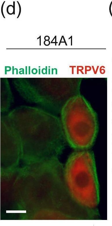 Fig.3.D showing Immunocytochemistry-immunofluorescence in a Homo sapiens (Human) sample from the publication: TRPV6 calcium channel directs homeostasis of the mammary epithelial sheets and controls epithelial mesenchymal transition.
