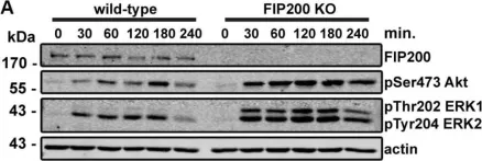 Fig.4.A showing Western Blotting in a Homo sapiens (Human) sample from the publication: Loss of the Essential Autophagy Regulators FIP200 or Atg5 Leads to Distinct Effects on Focal Adhesion Composition and Organization.