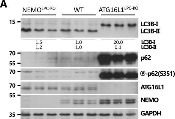 p62 Promotes Survival and Hepatocarcinogenesis in Mice with Liver-Specific NEMO Ablation.