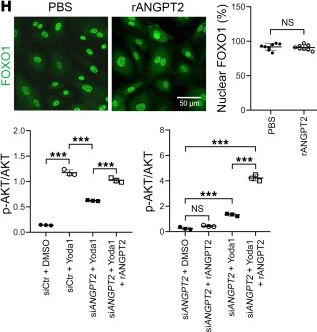 Fig.5.H showing Immunocytochemistry-immunofluorescence from the publication: The mechanosensory channel PIEZO1 functions upstream of angiopoietin/TIE/FOXO1 signaling in lymphatic development.