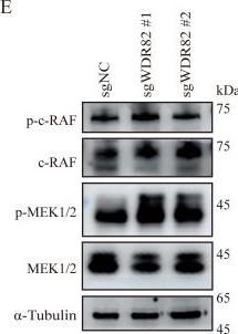 Fig.5.E showing Western Blotting in a Mus musculus (House mouse) sample from the publication: WDR82 suppresses breast cancer progression by inhibiting ERK-driven chemokine expression and neutrophil infiltration.