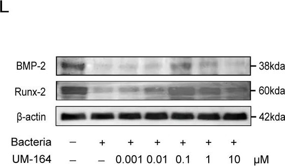 Fig.7.L showing Western Blotting in a Mus musculus (House mouse) sample from the publication: Enhancement of antibiotic therapy in osteomyelitis by inhibiting talin-1-mediated bacterial internalization.