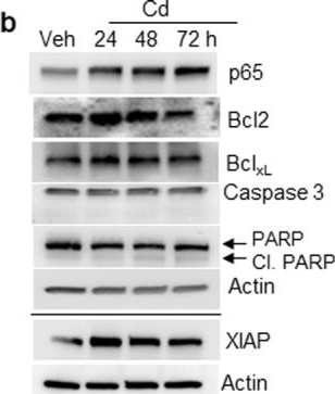 Fig.1.B showing Western Blotting in a Homo sapiens (Human) sample from the publication: Chronic exposure to cadmium induces a malignant transformation of benign prostate epithelial cells.