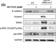 Fig.5.G showing Western Blotting from the publication: ARID1A-deficient cells require HDAC6 for progression of endometrial carcinoma.