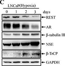Fig.1.C showing Western Blotting in a Homo sapiens (Human) sample from the publication: REST reduction is essential for hypoxia-induced neuroendocrine differentiation of prostate cancer cells by activating autophagy signaling.
